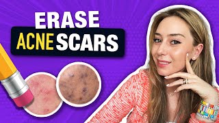 How to Treat amp Fade Acne Scars like a Dermatologist  Dr Shereene Idriss [upl. by Assirol94]