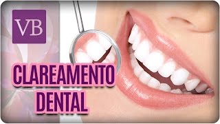 Mitos e Verdades do Clareamento Dental  Você Bonita 250117 [upl. by Dickson]