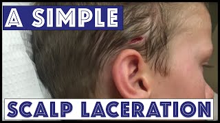 A Sunday Scalp Laceration [upl. by Ettezel]