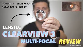 Lenstec CLEARVIEW 3 MultiFocal IOL Review  Cataract Surgery  Real Patient Feedback  No glasses [upl. by Peterus]