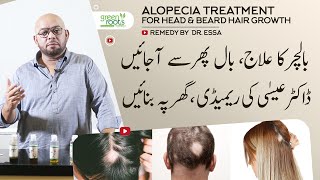 Alopecia treatment for head amp beard hair  alopecia hair growth oil Easy to make remedy by Dr Essa [upl. by Kristofer]