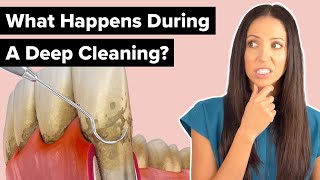 What Happens During a Deep Cleaning Procedure Scaling and Root Planing [upl. by Mairb641]