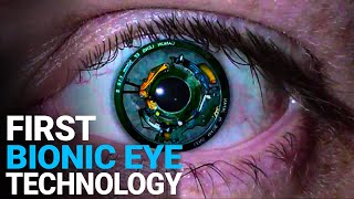 The Worlds First Bionic Eye Will Cure Blindness New Technologies CHANGE the WORLD Cool Technology [upl. by Arten]