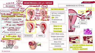 HEMORRAGIA DE LA PRIMERA MITAD DEL EMBARAZO ENAM 2020 [upl. by Krilov]