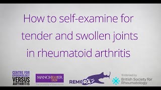 How to SelfExamine for Tender and Swollen Joints in Rheumatoid Arthritis [upl. by Elitnahc]