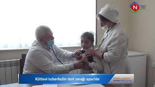 Kütləvi tuberkulin test sınağı aparılır [upl. by Fortunio]