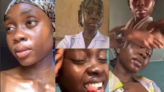 Nurse Yahwehs SHOCKING Atopa Video LEAKED Online [upl. by Powel]