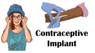 Contraceptive Progesterone Implant  Uses Mechanism Of Action Adverse Effects Contraindications [upl. by Ennoryt]