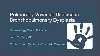 Pulmonary Vascular Disease in Bronchopulmonary Dysplasia Moving From Acute to Chronic Management [upl. by Illek272]