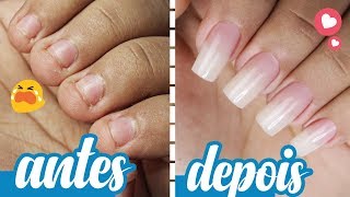 TRANSFORMAÇÃO DE UNHAS CURTAS E ROÍDAS  ANTES E DEPOIS [upl. by Sheela]