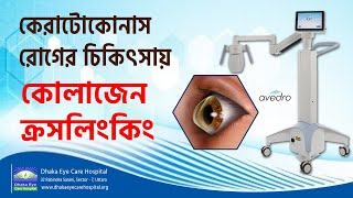 Keratoconus Treatment  Prof Dr Harun Ur Rashid  Dhaka Eye Care Hospital [upl. by Oitaroh697]