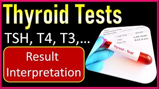 Thyroid Test  TSH T4 T3 Tests Explained  Thyroid Test Report Interpretation [upl. by Glimp73]