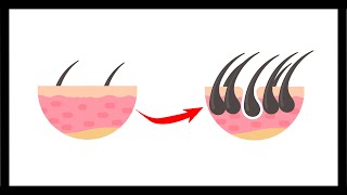 Así funciona la clonación de pelo [upl. by Fina559]