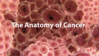 What Is Cancer What Causes Cancer amp How Is It Treated [upl. by Turk]