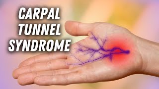 Carpal Tunnel Syndrome What It Is and Why It Happens [upl. by Sukramaj]