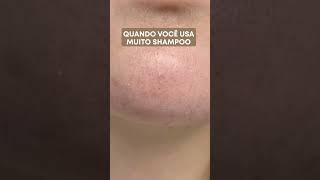 Será que você está usando a quantidade ideal de shampoo [upl. by Huskamp]