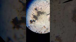 Silver staining of Treponema pallidum medicoaanchal03 shorts biology neet mbbs reel microbe [upl. by Helbonia]