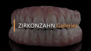 Digitaler Workflow implantatgetragene Komplettversorgung aus Prettau® 2  ZirkonzahnGalleries [upl. by Downes]