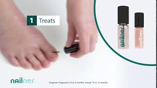 Nailner TreatampColour  Effective fungal nail treatment with colour [upl. by Bruckner]