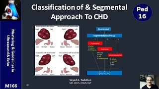 Classification of amp Segmental Approach To Congenital Heart Diseases CHD [upl. by Isolda]