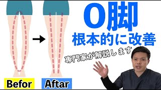 【O脚改善】専門家が解説します。XO脚を根本的に改善させる方法！【埼玉県鴻巣市 〜腰痛治療家 〜高嶺 朝貴】 [upl. by Eceinhoj]