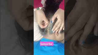 ASMR  Scalp Check and Treatment hair asmrscalp scalp shorts [upl. by Turner940]