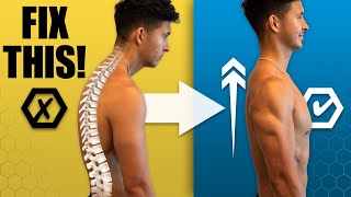 The Best Posture Workout At Home FIX YOUR HUNCHBACK [upl. by Acinoryt]