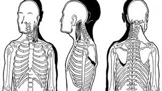 Adaptive Shortening of Muscles [upl. by Adne]