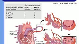 UNDERSTAND CARDIOPULMONARY INTERACT TO AVOID CLINICAL DISASTERS JD Chiche 2015 [upl. by Nnylhtak]