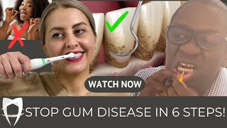 Gum Disease Treatment 2024  Periodontists Comprehensive Guide Including Causes and Treatment [upl. by Nnairac]