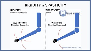 Rigidity vs Spasticity Explained [upl. by Gnat]