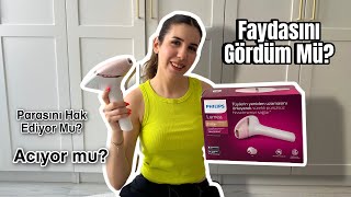 Philips Lumea Almadan Önce Mutlaka İzleyin✨ Prestige IPL BRI950 Modeli İnceleme ve Yorumlarım🌸 [upl. by Mcdade199]