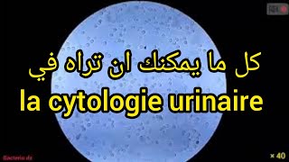 كل ما يمكن ان تراه في la cytologie urinaire [upl. by Lavotsirc]