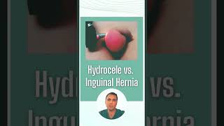 Hydrocele vs inguinal hernia [upl. by Egas981]