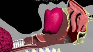 Endotracheal Intubation Animation by Cal Shipley MD [upl. by Clie]