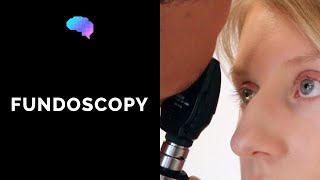 Fundoscopy Ophthalmoscopy  OSCE Guide  UKMLA  CPSA [upl. by Eelirem]