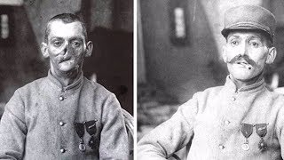 Sculptor Made Masks for Wounded WWI Soldiers with Disfigured Faces  New York Post [upl. by Araeic]