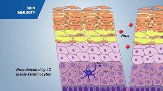 Immune response in the skin [upl. by Dickerson174]