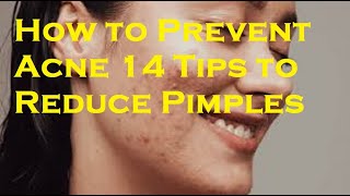 How to Prevent Acne 14 Tips to Reduce Pimples [upl. by Rettke]