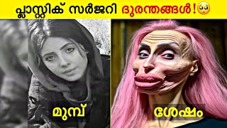 പ്ലാസ്റ്റിക് സർജറി ചെയ്ത് പണി പാളി🥲  Before And After Plastic Surgery [upl. by Gnolb]