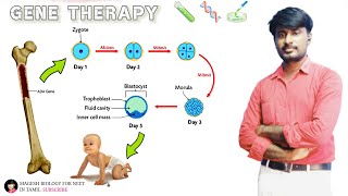 Gene therapy  ADA deficiency  MAGESHBIOLOGY [upl. by Esta]