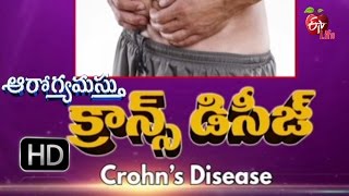 Aarogyamastu  Crohns Disease  20th January 2017  ఆరోగ్యమస్తు [upl. by Waldos]