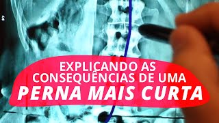 Explicando as consequências de uma perna mais curta [upl. by Assirroc]