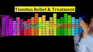 Tinnitus Relief Sound Therapy Treatment  1 Hour of Tinnitus Masking with Rain Sound [upl. by Niawd]