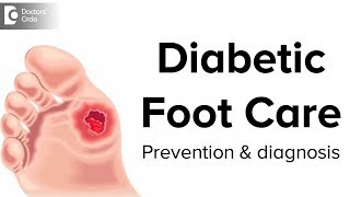 Diabetic Foot Care  Prevention and Diagnosis  Dr Mohan M R [upl. by Julio179]