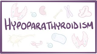 Hypoparathyroidism  causes symptoms diagnosis treatment pathology [upl. by Elleneg]