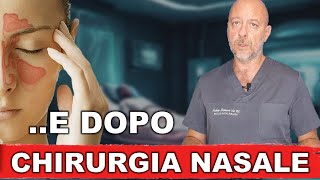 Dopo la chirurgia endoscopica nasale [upl. by Noizneb]