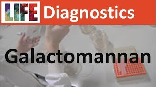 Galactomannan testing for disseminated AspergillusTalaromycesHistoplasma infections [upl. by Adnuahsar]