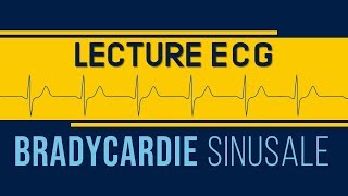 Interprétation ECG  Bradycardie Sinusale [upl. by Kile]