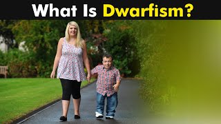 What is Dwarfism  Types Causes and Symptoms UrduHindi [upl. by Quent]